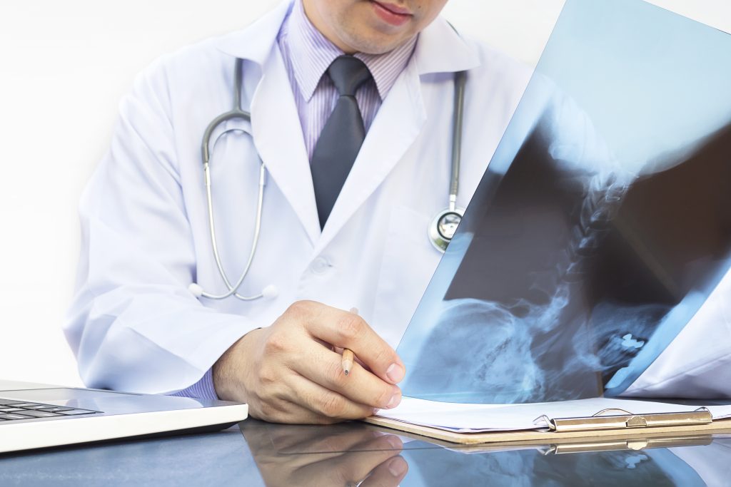 Un doctor visionando una placa de rayos X