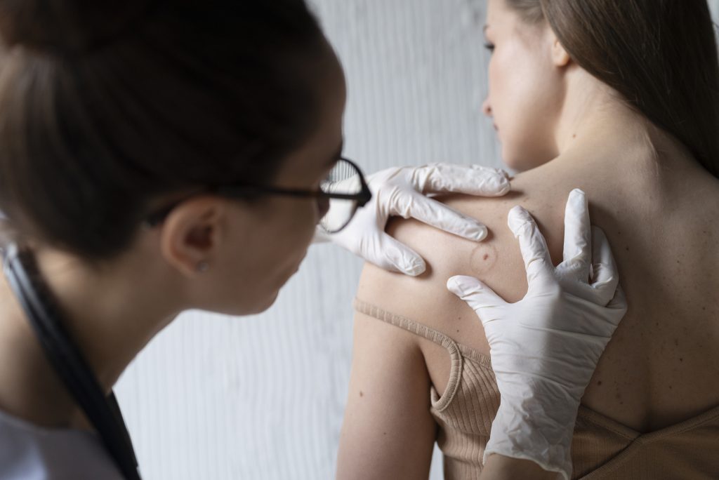 Una doctora revisando la espalda de una mujer por si tiene manchas