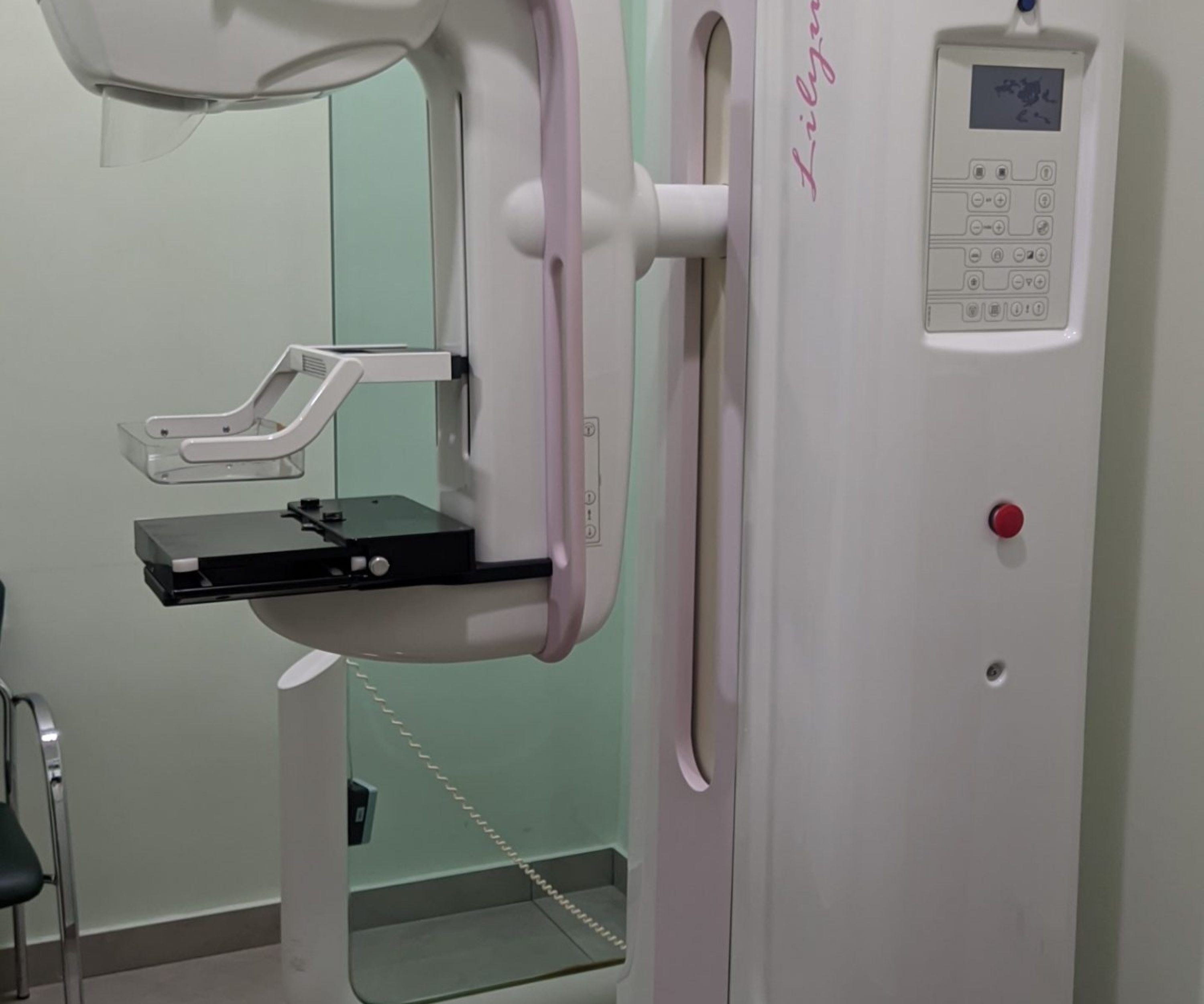 Imagen de un mamógrafo de alto rendimiento